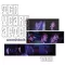 TEN YEARS AFTER: Woodstock 1969 (2LP)